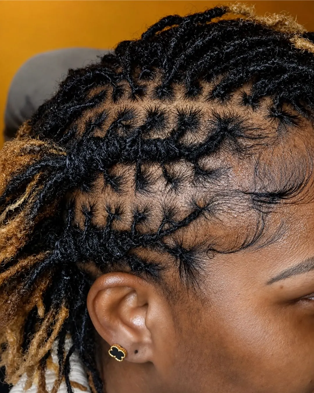 Close up of a temple, microlocs parted off a hairline that is still fully intact, with fine baby hairs along the edge